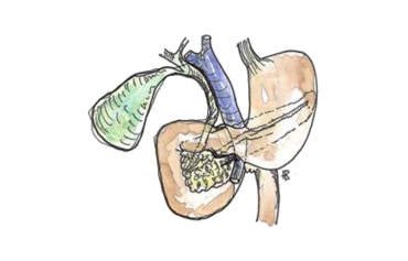 Eine Abbildung der Anatomie der Bauchspeicheldrüse